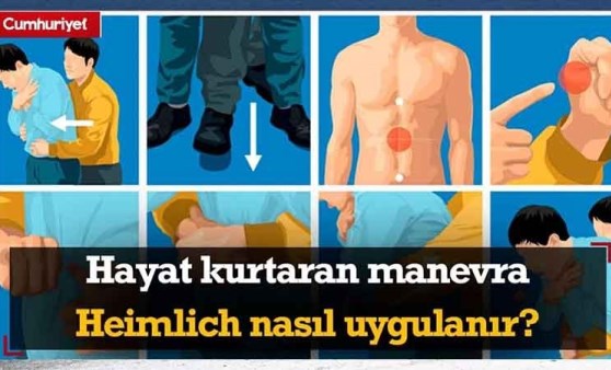 Hayat kurtaran manevra Heimlich nedir? Nasıl uygulanır?