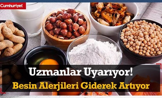 Uzmanlar uyarıyor: 'Besin alerjileri, giderek artıyor'